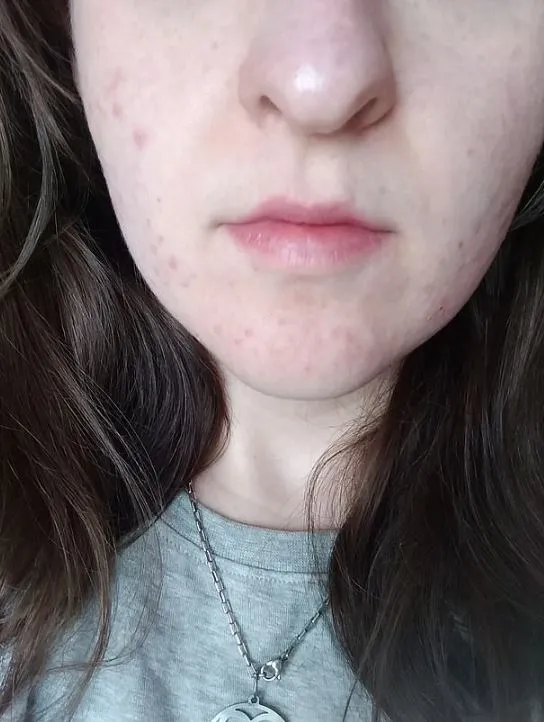 woman is dumped and accused of catfishing by her boyfriend after going make 7435