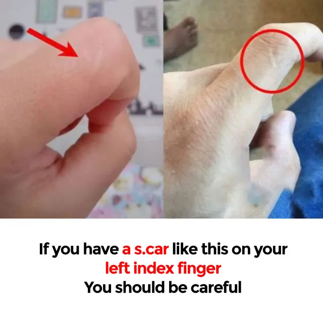 what does it mean if you have a scar on your left index finger? 8368