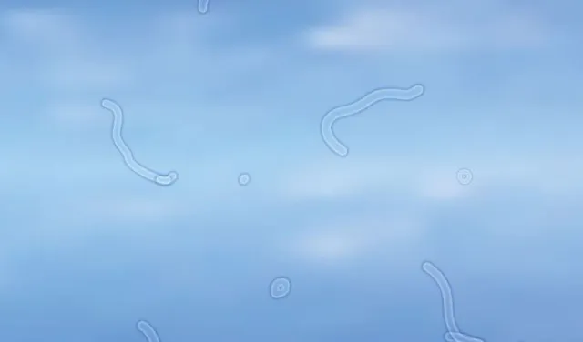 eye doctor explains how to handle deeing floaters 8688