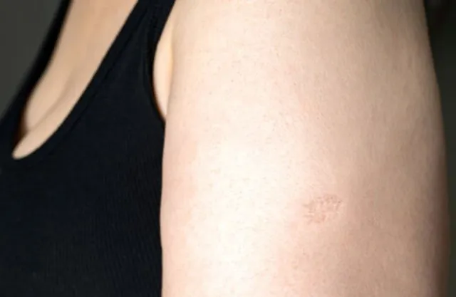people are just realizing the real meaning of the small scar on the upper l 11263