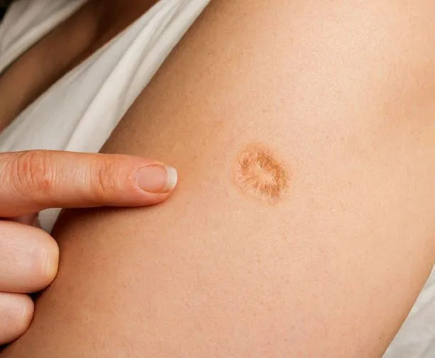 people are just realizing the real meaning of the small scar on the upper l 11266