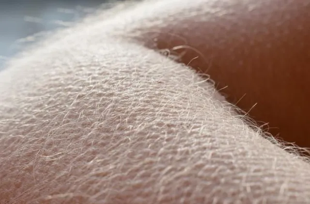 what causes us to get goosebumps when experiencing strong emotions? 11529