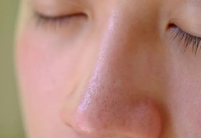 people are just realizing that tiny spots on their nose are actually not bl 11894