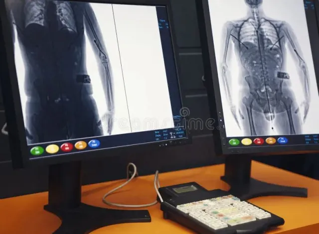 people stunned by what security saw in x-ray machine 12259