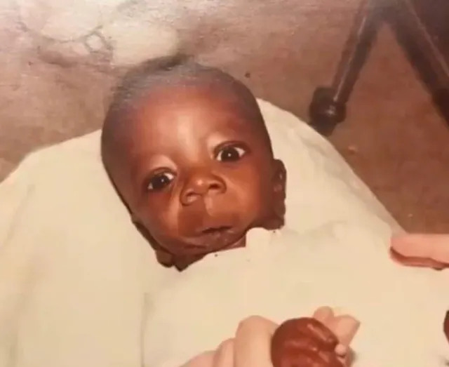 man who was born without jaw sparks heated controversy after finding heartf 13328