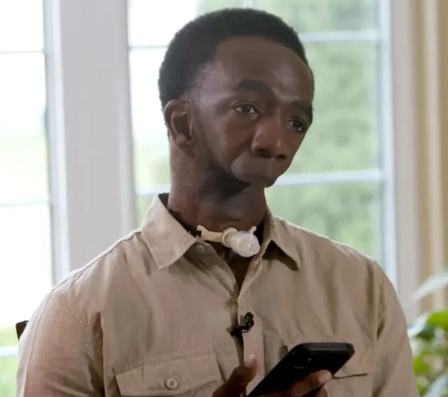 man who was born without jaw sparks heated controversy after finding heartf 13327