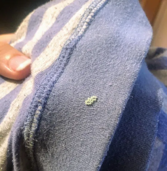 what are those little circles that appear when we hang clothes outside? 13393