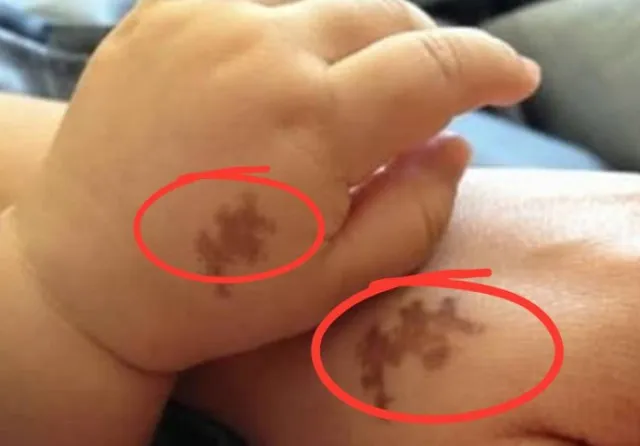 could our birthmarks be evidence of past life experiences? 13476