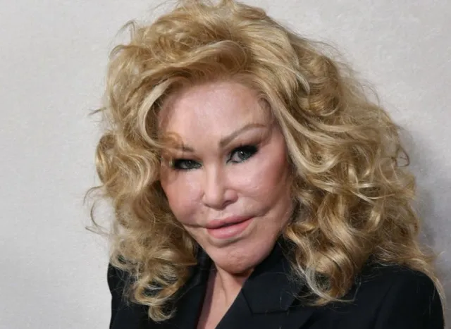 catwoman jocelyn wildenstein passes away at 84 while traveling to paris w 13667