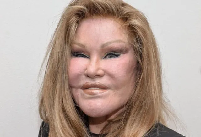 catwoman jocelyn wildenstein passes away at 84 while traveling to paris w 13665