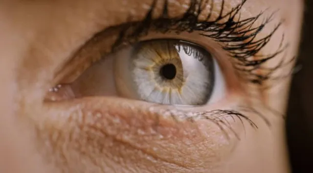 woman reveals how eye color change surgery from brown to blue changed her l 13887