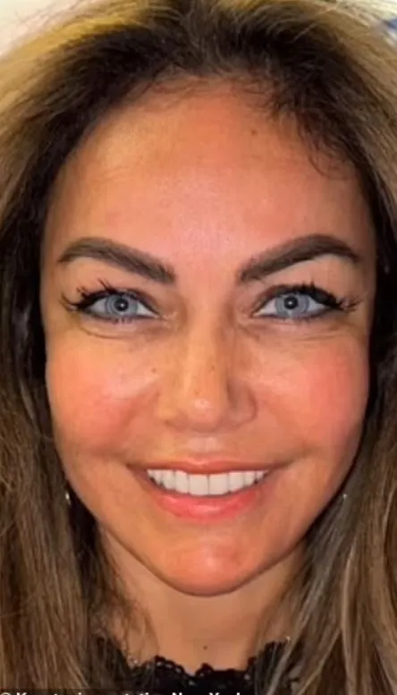 woman reveals how eye color change surgery from brown to blue changed her l 13884
