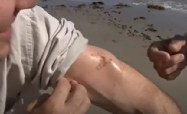 man films himself being stung by worlds most venomous creature to see how 15230