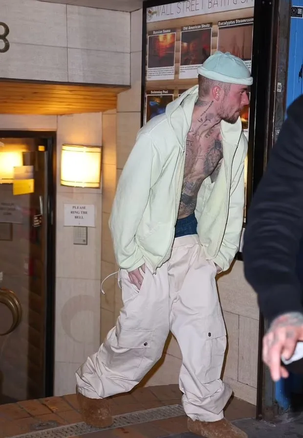 fans concerned for justin biebers health and marriage after he appears hal 16290