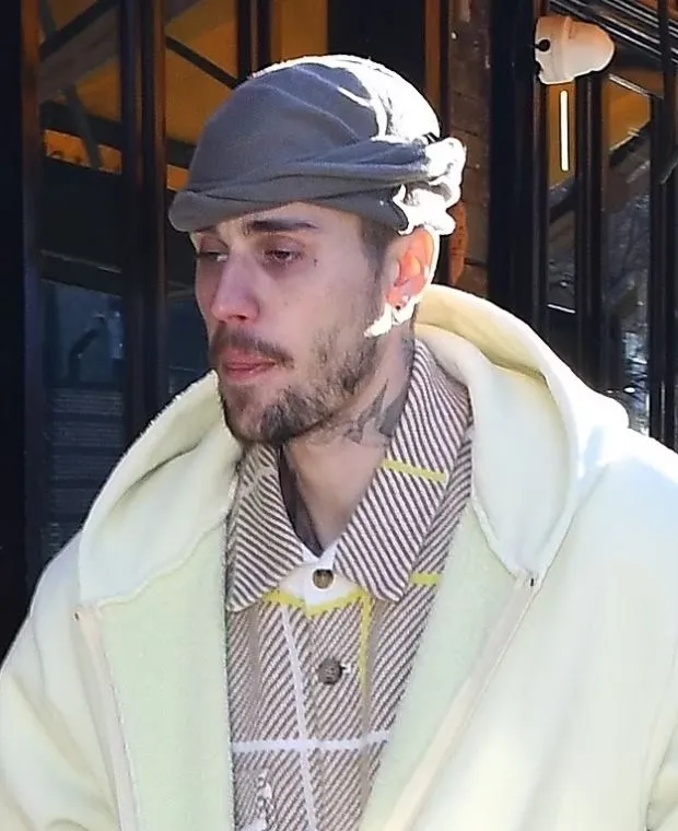 doctor exposes potential silent health issues affecting justin bieber 16389