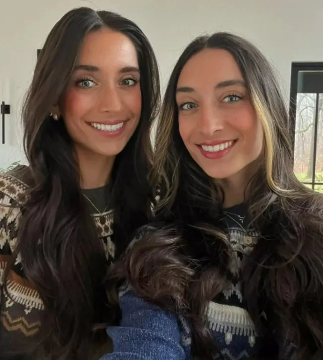 remarkable journey of extremely rare momo twins who were given just one p 16523