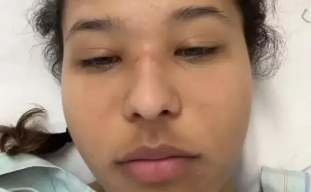 california woman breaks bone due to dangerous gym trend 16858