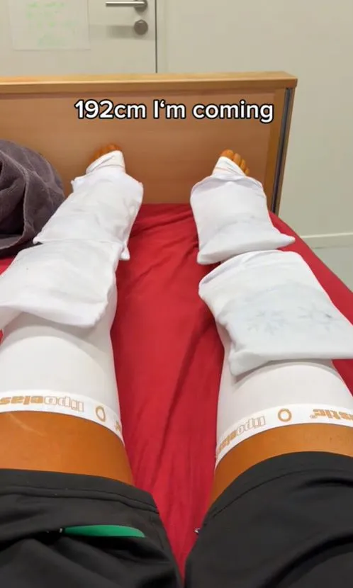 man shares his painful experience after breaking his own legs to add 9 inch 17954