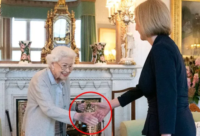 people scared as they compare the bruise on trumps hand to queen elizabeth 18170