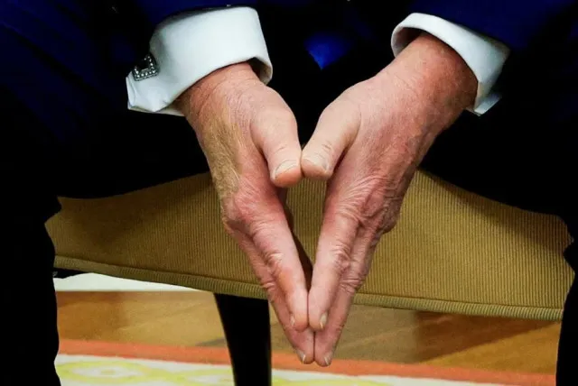 white house responds after bruise on trumps hand sparks health concerns 18150