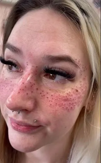 tattoo artist shows off freckles she inked on customer who travelled 900 mi 18927