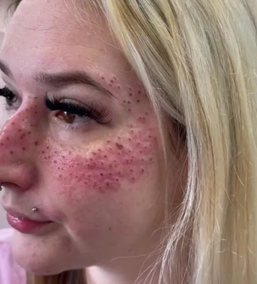 tattoo artist shows off freckles she inked on customer who travelled 900 mi 18925