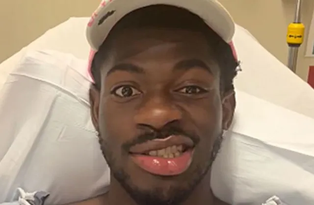lil nas x fans concerned as he reveals right side of his face is paralyzed 22109