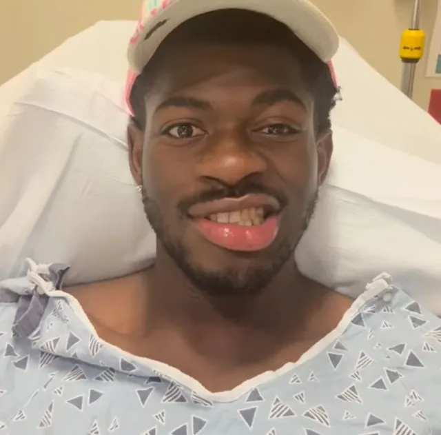 lil nas x fans concerned as he reveals right side of his face is paralyzed 22108
